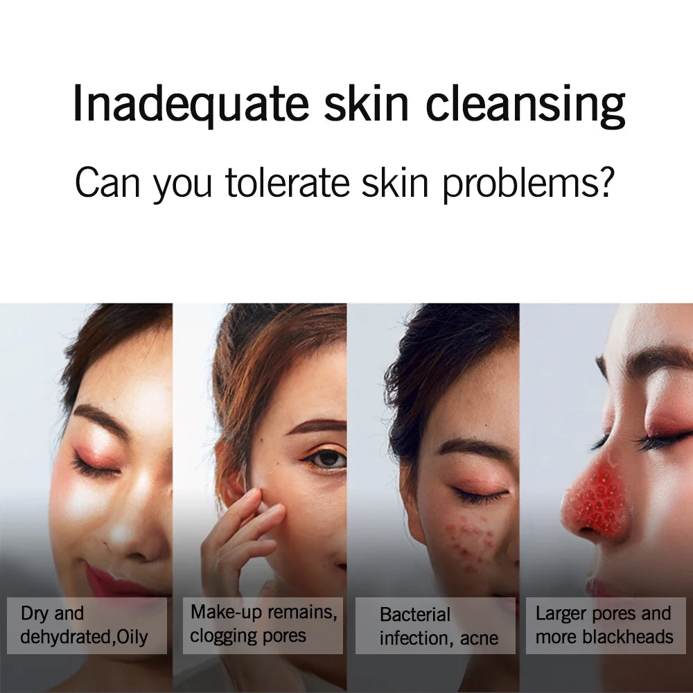 Blackhead Remover Vacuum,  Electric Facial Pore Cleaner Blackhead Suction Acne Pimple Extractor Pore Tool with LED Screen & USB Rechargeable