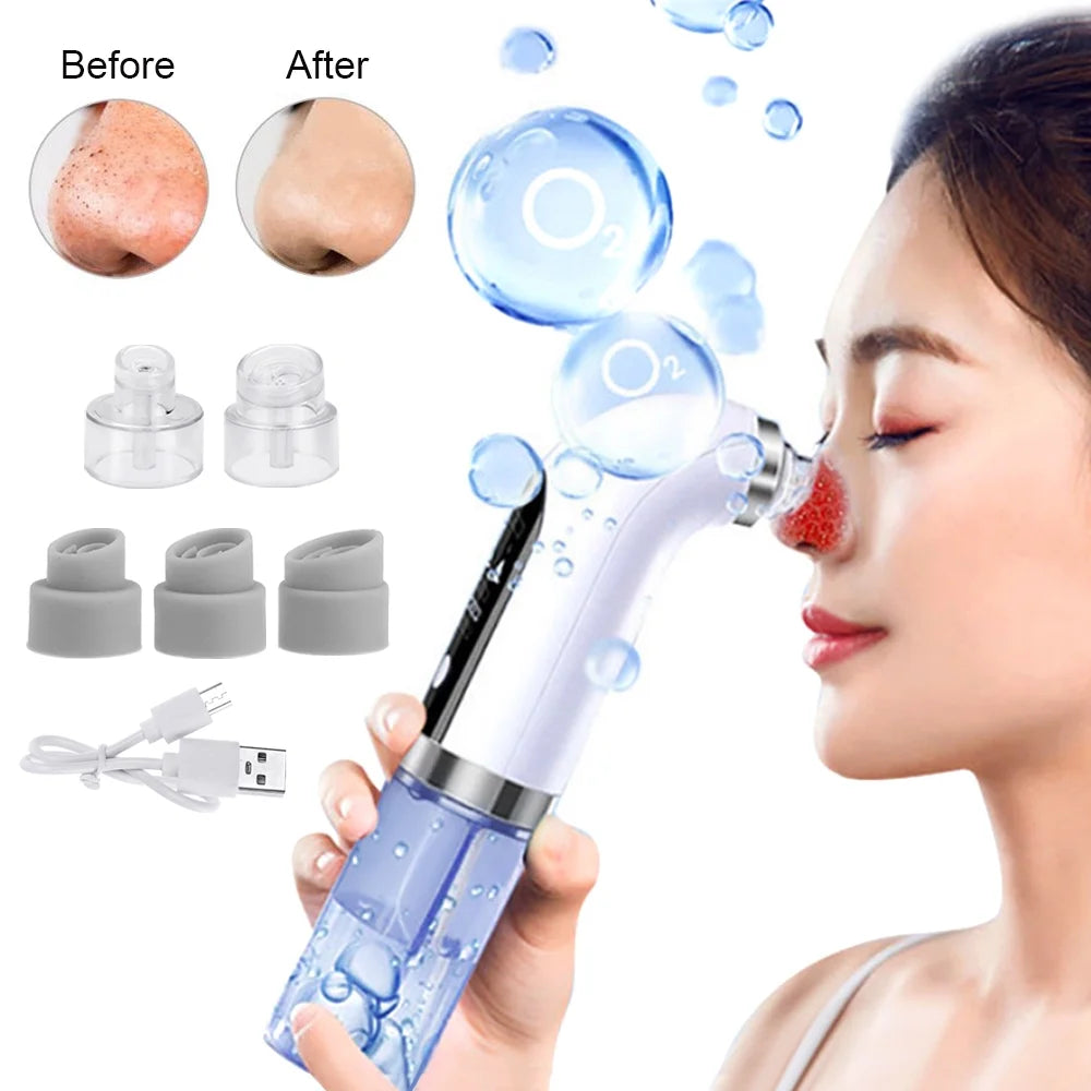 Blackhead Remover Vacuum,  Electric Facial Pore Cleaner Blackhead Suction Acne Pimple Extractor Pore Tool with LED Screen & USB Rechargeable